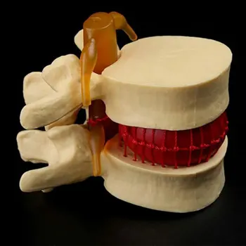 Anatomijas Mugurkaula Jostas Disku Modeli, Elastīgi Un Kompakti, Precīzi Medicīnas Demonstrācijas Viegli